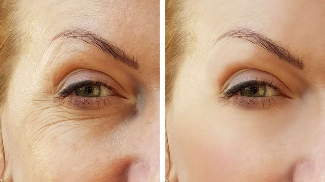 Laser Me: Aesthetics & Wellness : Best Injectables