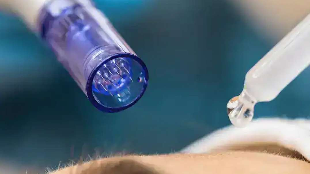 Belle Ame Skin And Beauty : #1 Permanent Makeup in Vancouver, BC